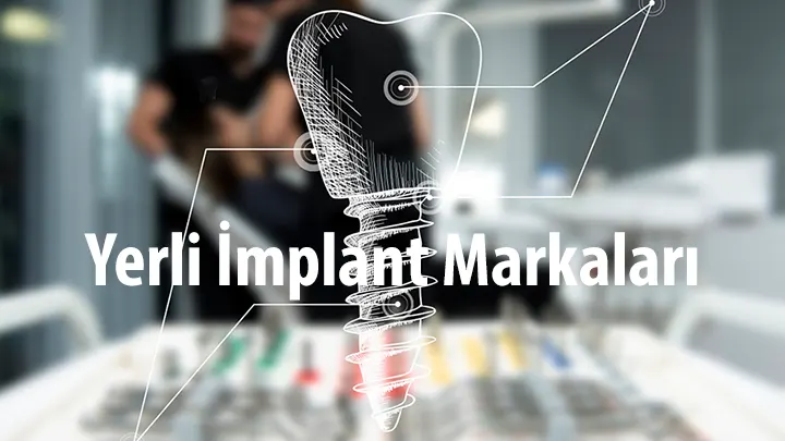 Yerli İmplant Fiyatları, En İyi Yerli İmplant Markaları Tavsiye ve Yorumlar